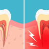 Cum tratezi natural durerile de măsea? Un secret pe care medicii stomatologi ti l-au ascuns