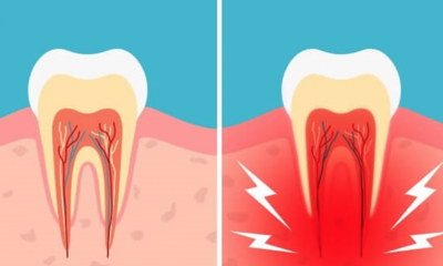 Cum tratezi natural durerile de măsea? Un secret pe care medicii stomatologi ti l-au ascuns