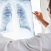 Hipertensiunea pulmonara: ce este, care sunt cauzele, simptomele si ce complicatii pot sa apara