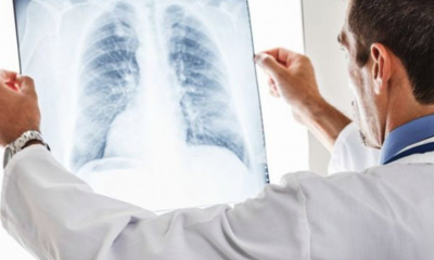 Hipertensiunea pulmonara: ce este, care sunt cauzele, simptomele si ce complicatii pot sa apara
