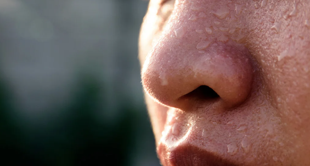 Transpirația excesivă a feței și a capului: de ce apare și cum se tratează?